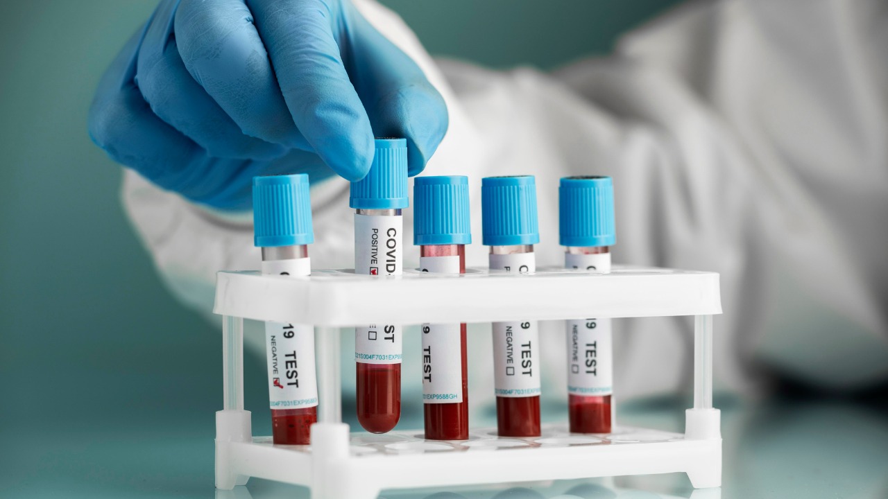 Convenient and Reliable Blood Test at Home Bangalore